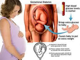 varice vulvaire grossesse et accouchement