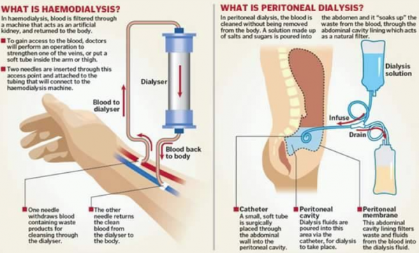 Dialyse2